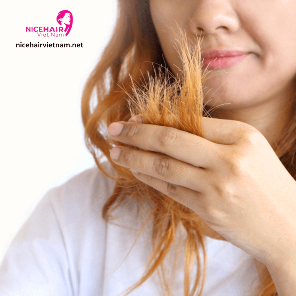 Hair breakage might occur because of improper installation or removal